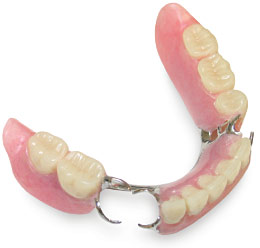removable-partial-denture2